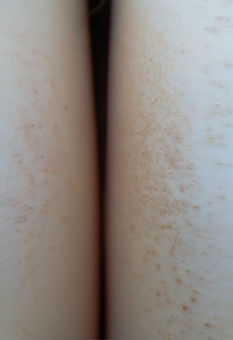 lazypos-masterpiece-sharp-focus-tack-sharp-2adb17 on iNiverse Mix(SFW & NSFW)