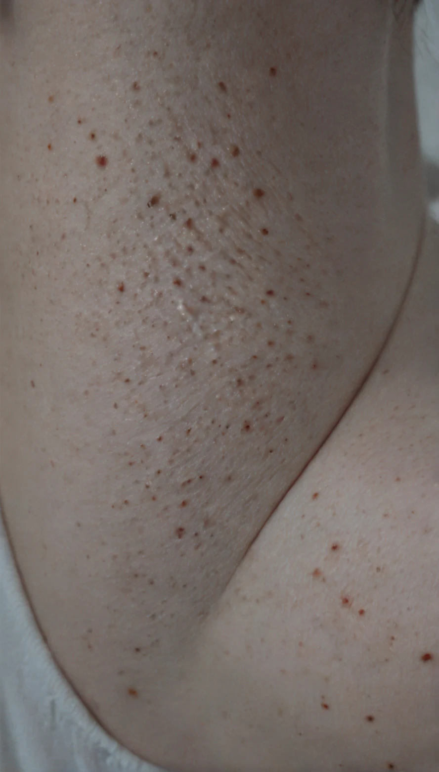 lazypos-masterwork-masterpiece-best-quality-detailed-6dc729 on iNiverse Mix(SFW & NSFW)